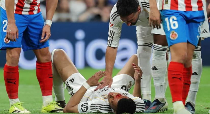 Kylian Mbappét véresre könyökölték a legutóbbi meccsen, kiderült, játszhat-e a BL-ben