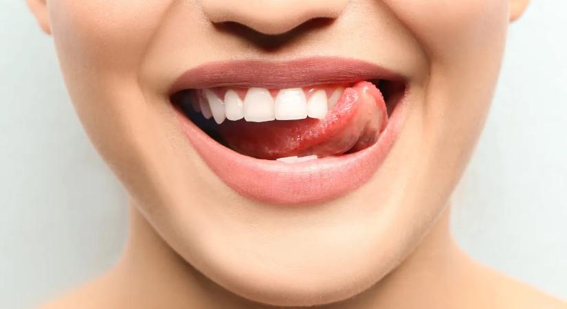 Ezek az ételek és italok károsítják a fogzománcot – Kerüld el őket és a fogorvost is