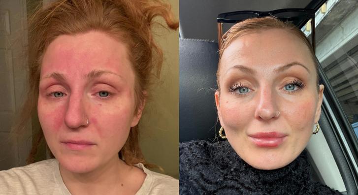 „Azt hittem, laktózérzékeny vagyok, de csak a házasságomra voltam allergiás” – Válása után felismerhetetlenné vált Klaudia