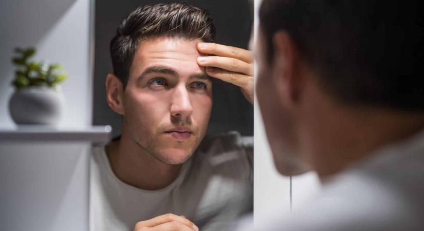 Kollagénmítosz: sokan költenek feleslegesen a táplálékkiegészítőre a belgyógyász szerint