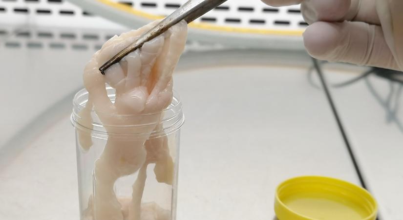 Galandféreg és nejlonzacskó: bizarr fogyókúrák hódítanak