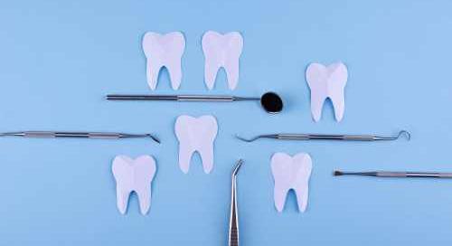 Fogászati ellátások: az egyik legnépszerűbb egészségpénztári szolgáltatás