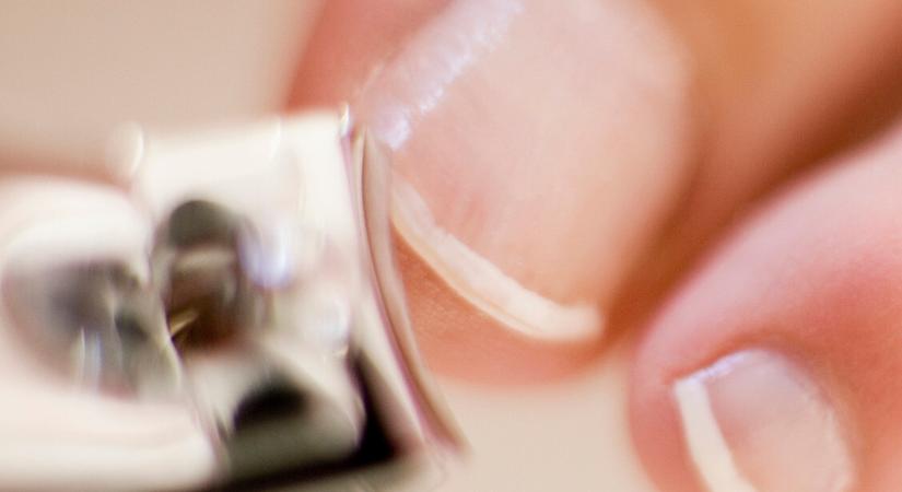 Mit jeleznek a körmön futó barázdák? – Kvíz: 7/7 csak a legjobbaknak megy!