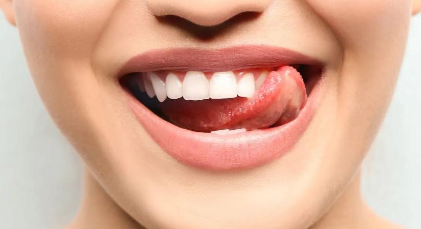 Ezek az ételek és italok károsítják a fogzománcot