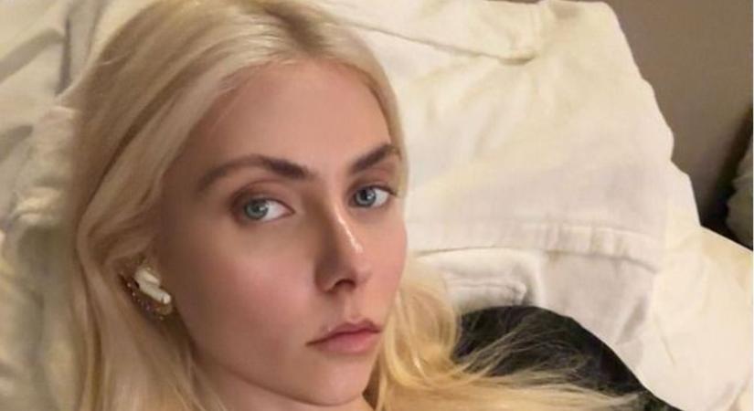 Ez fájhatott! Kórházba szállították Taylor Momsent egy mérges pókmarás miatt