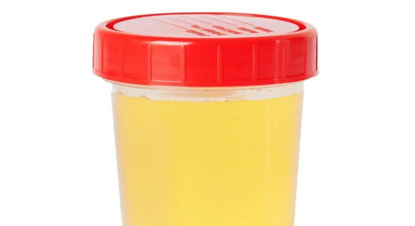 Pozitív lett a magyar sztárkerékpáros doppingtesztje