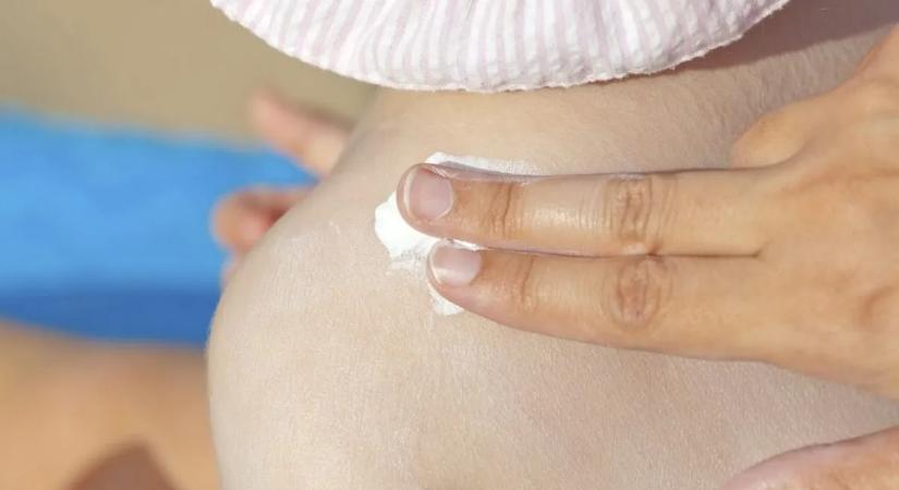 Évekkel előre tudni lehet, kinél alakulhat ki bőrrák