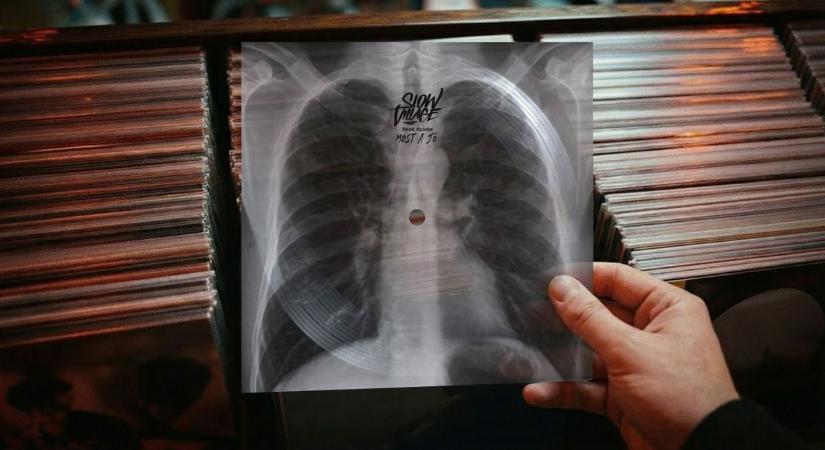 Láthatatlan járvány terjed - Már minden negyedik tinédzser vape-ezik