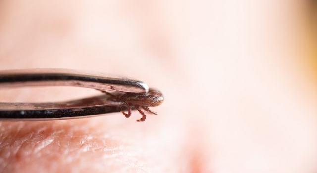 Életveszélyes allergiát okozhat a kullancscsípés: a kutyád és te is veszélyben vagytok