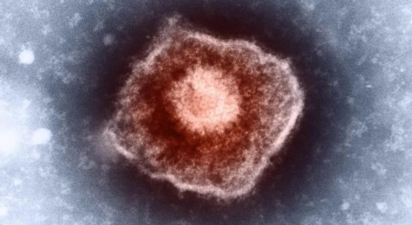 Szenzációs áttörés: kigyógyult a HIV-ből egy férfi a műtét után