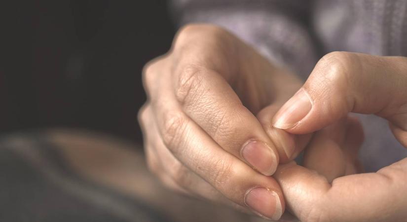 Íme a körmökön megjelenő finom jel, ami súlyos betegségekre is figyelmeztethet