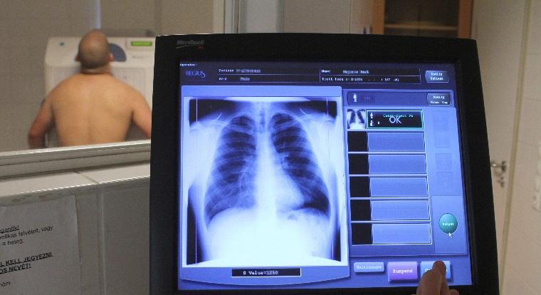 Egészségnap lesz Sárándon