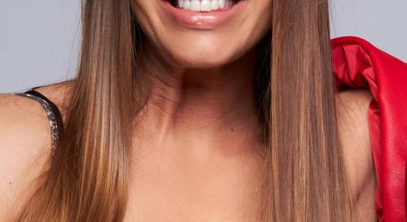 A magyar énekesnőt szétszedték, miután plasztikáztatta az arcát: Mickey Rourke-hoz hasonlították