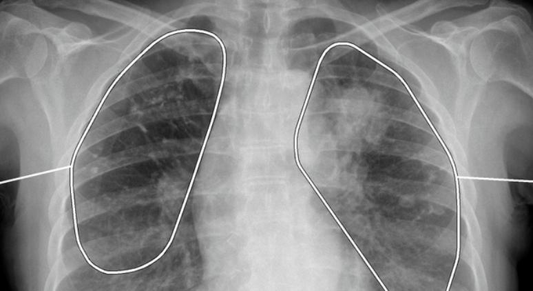 Kiderült, mi történik a halál pillanatában: az orvosokat is megdöbbentette