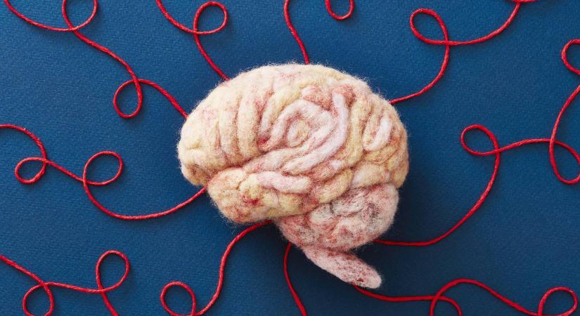 Az orvosok legjobb tippjei: így óvhatjuk meg az agy egészségét a mindennapokban