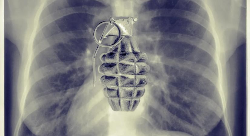 Időzített bomba ketyeg a testedben: csak a kardiológia „Szent Grálja” hatástalaníthatja időben