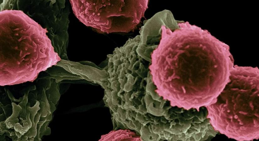 Ijesztő számok: ez a tényező sokaknál növelheti a rák kockázatát