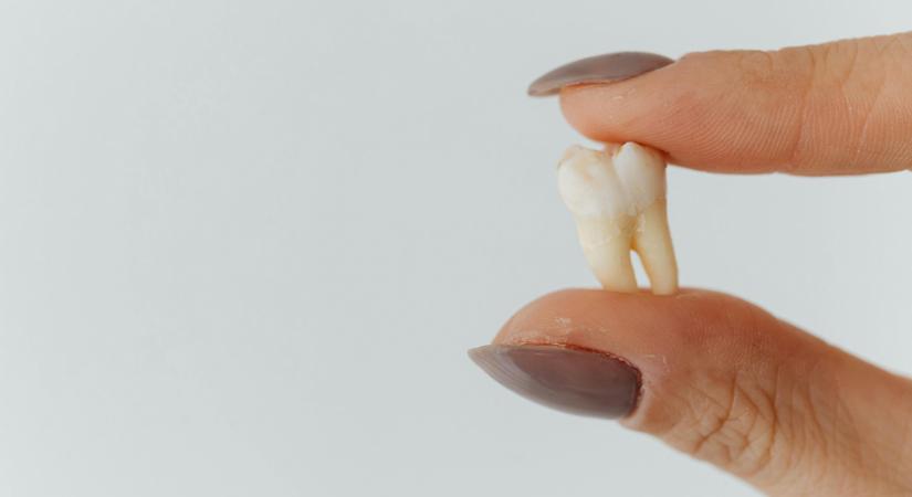 Olcsó török fogorvost választott az apa: Pár nap múlva egy foga sem maradt