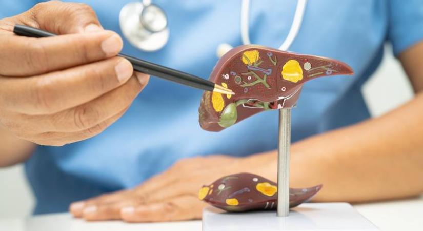 Ez a negyedik leggyakoribb halálok Magyarországon – Évekig tünetmentes lehet