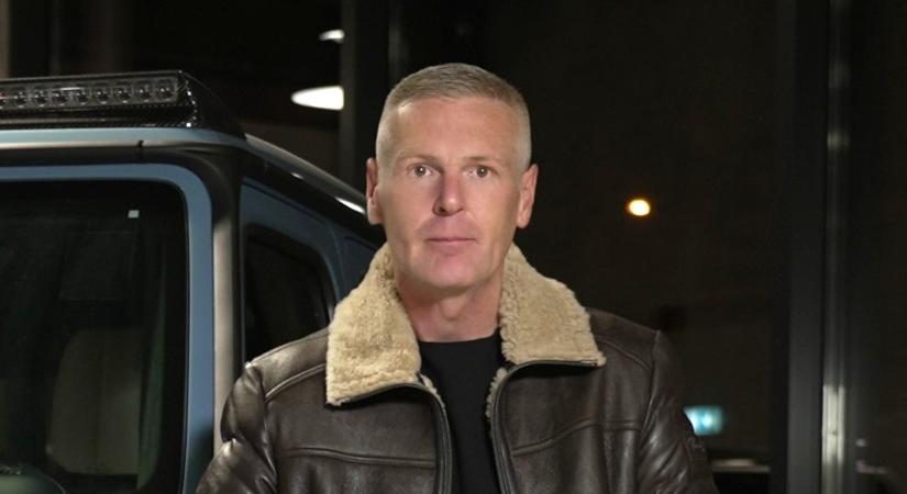 Így változott meg a plasztikától a magyar James Bond arca