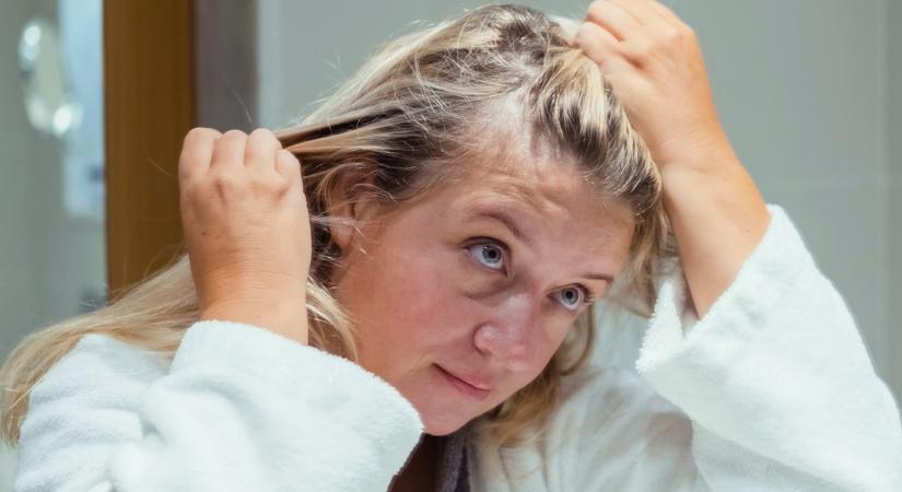 Mondj búcsút a hajhullásnak: Ez a gyógynövény egyszerre megoldja