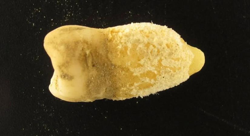 Egy bolíviai múmia foga átírhatja a történelemkönyveket – nem az európaiak hozták a skarlátot?!