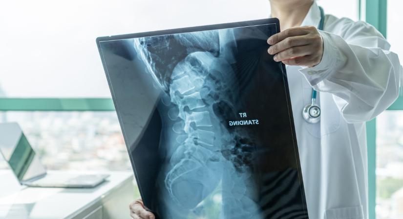 „11 helyen törte el a gerincemet a rák, most mégis hegyet mászok”