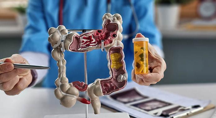 Probiotikumok: melyik készítmény a megfelelő számomra?