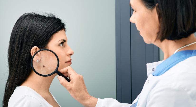 Hogy néz ki a bőrrák? – Képeken mutatjuk a gyanús elváltozásokat