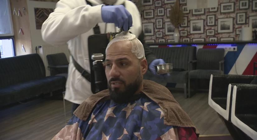 Minden második férfit érint a hajhullás – a kopaszodás lelki oldala