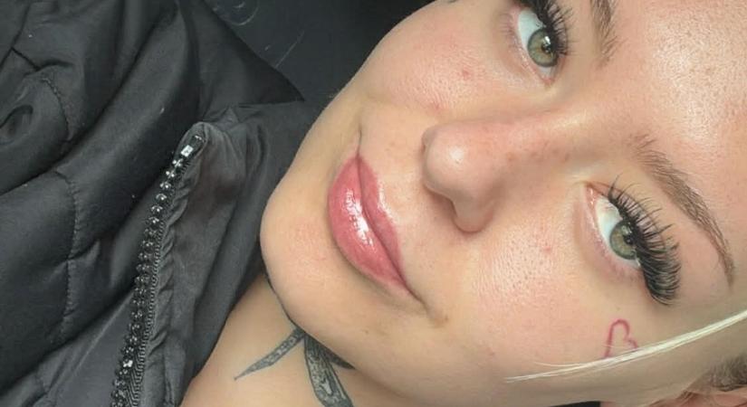 18 hónapja maradt hátra a 22 éves nőnek: „Nem tudtam felemelni a fejem”