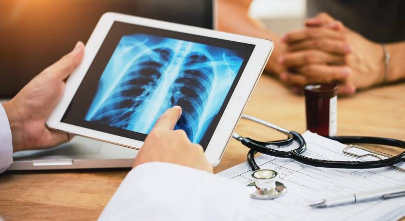 Miért alakulhat ki tüdőrák nem dohányzó fiataloknál? Meglepő választ találtak a kutatók