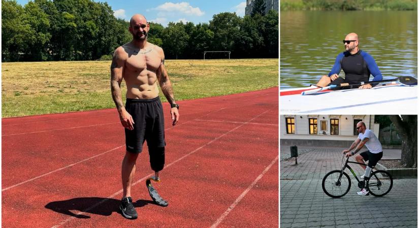 „Azt mondtam, vissza akarom kapni az életem” – Tamás maga kérte, hogy vágják le a lábát