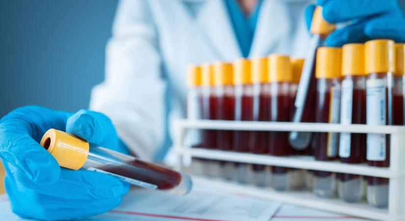 Vérvétel: mettől számít magasnak a limfocita-érték?