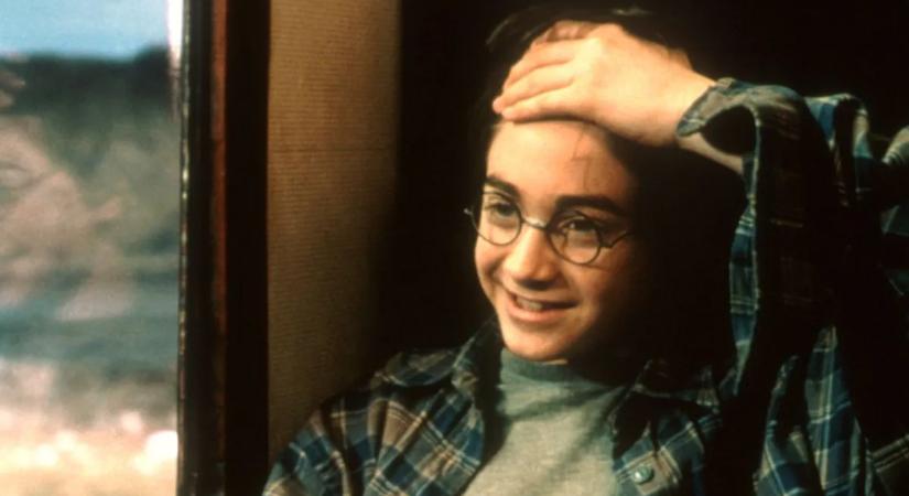Létezik Harry Potter sebhelye: ha így látod magadon, te vagy a kiválasztott