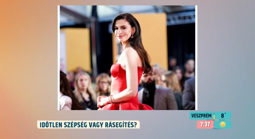 Időtlen szépség vagy beavatkozás? Anne Hathaway arcáról és a plasztikáról beszél a szakértő