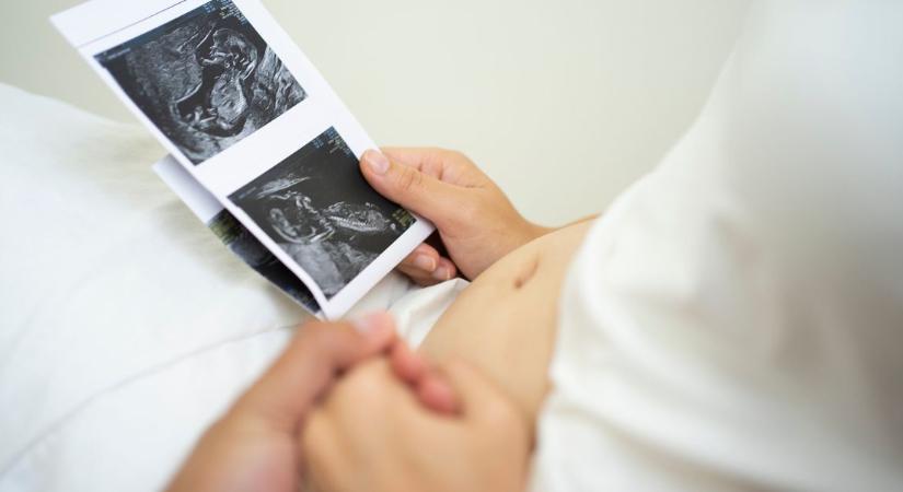 Terhességi ultrahang: 40 hét csodája képekben