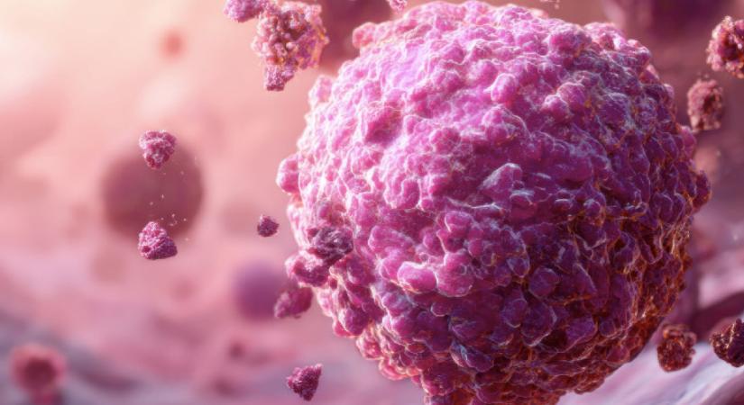 Nem vagy házas? Ennyivel nő az esélye, hogy rákos leszel - A nőknél nagyobb a veszély