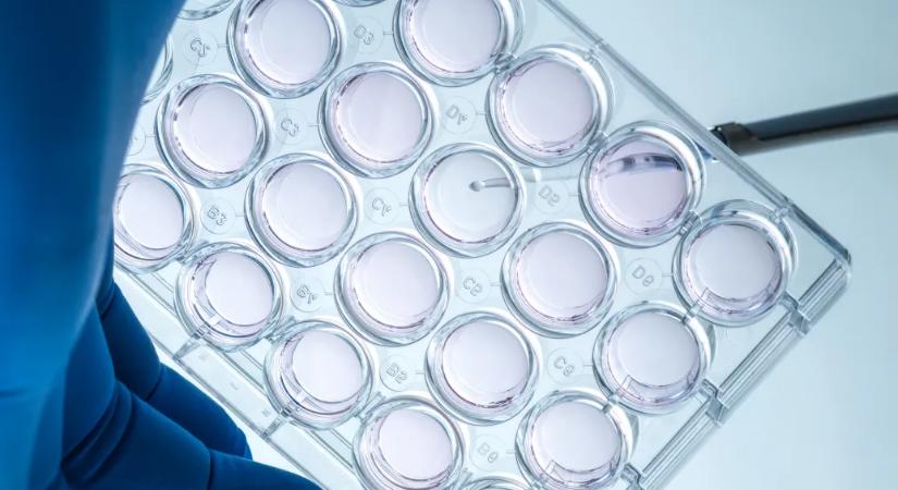 Az egyedi gyógyszerkérelmeket elbíráló alapítvány szerint felhalmozódtak a kérelmek, de nincsenek nagy csúszások