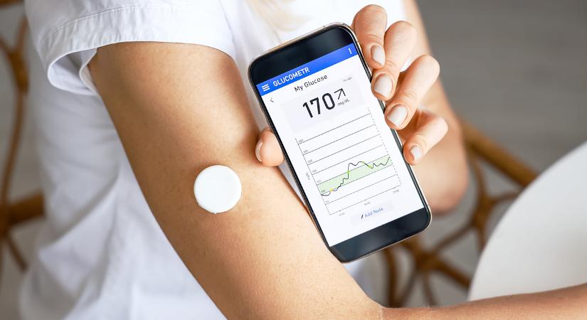 CGM – mit árulnak el a szöveti cukor monitorozással mért értékek?