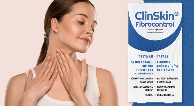 Fibróma (bőrkinövés) kezelésére. Hatékony, fájdalommentes eltávolítás otthon.