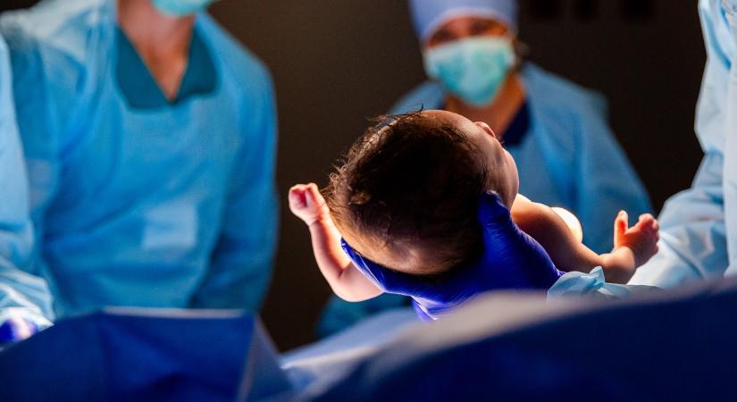 Meghalt a bravúros műtéttel szétválasztott sziámi ikrek egyike