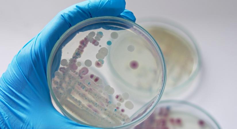 A fertőzöttek 20 százaléka 48 órán belül meghalhat! Húsevő baktérium gócpontjait fedezték fel