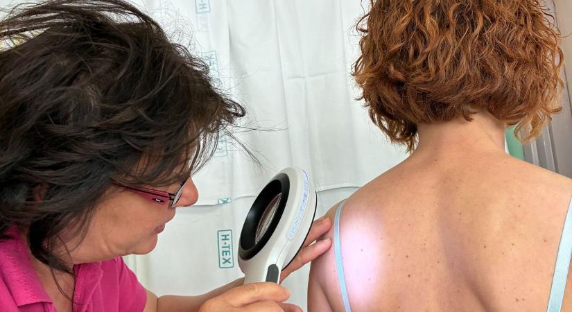 Ezek a bőrrák árulkodó jelei: óriási szerepe van a megelőzésben az önvizsgálatnak!