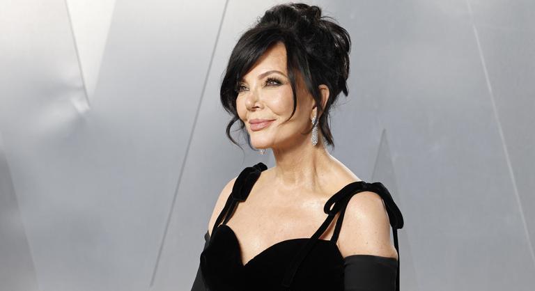 Megtelt az internet Kris Jenner arcképével, és azt is megtudtuk, miért