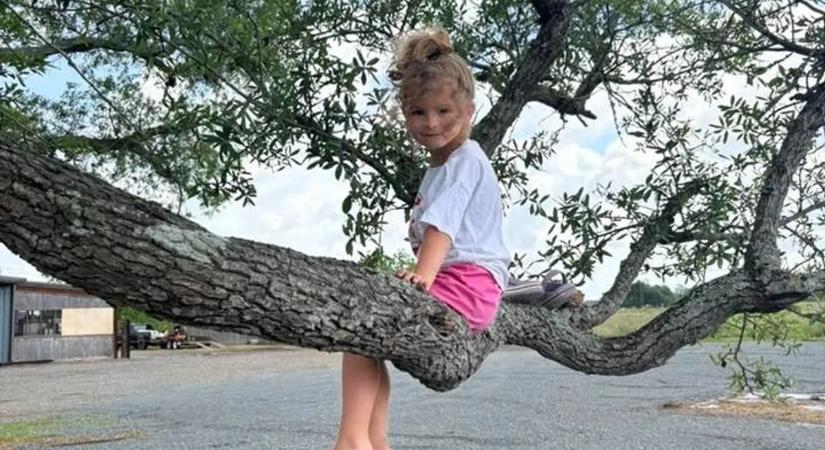 Genetikai rendellenességgel küzd a 6 éves kislány, fémrudakkal hosszabbítják meg a gyermek lábait