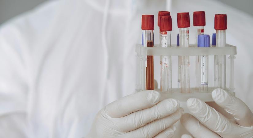 Egy halálos afrikai vírusra figyelmeztetnek a kutatók: hasonlóan terjed, mint a Covid-19, tizenhárom nap alatt megöli az embert