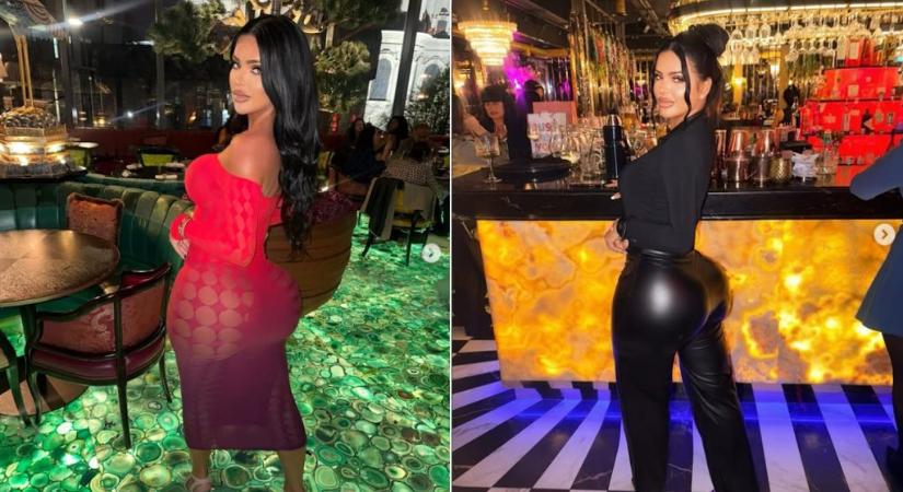 Belehalt sérülésébe az influenszer, akit a brit X-Faktor sztárja gázolt el