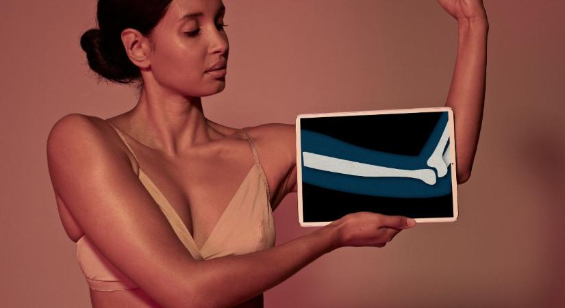 7 jel, hogy már 65 éves korod előtt el kell menned csontsűrűség-vizsgálatra