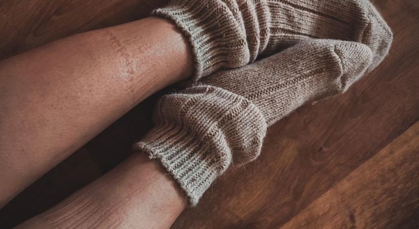 Mit jelentenek a boka körüli zokninyomok? Egy jel, amit sokan félvállról vesznek